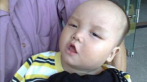 吃白色的瓜舌头疼,揭秘饮食与健康的关系